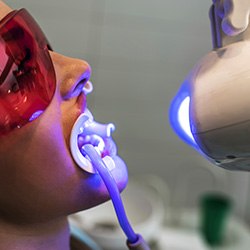 Patient receiving in-office teeth whitening treatment