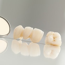 Dental crown and fixed bridge restoration on table